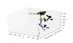 Measured movements of the different sensors during a FETO surgery