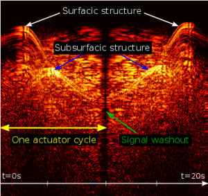 M-mode image taken with the actuator moving the PA/US probe over an ex vivo placenta