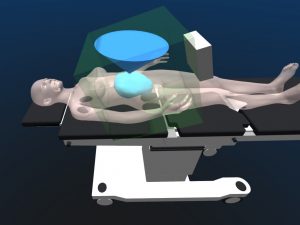 3D rendering of the positioning of the Aurora field generator in the OR