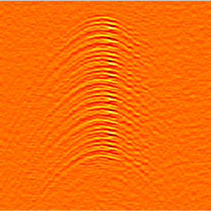 Ultrasound Waves